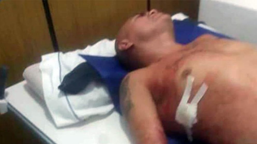 El pugilista fue internado de urgencia con graves heridas.