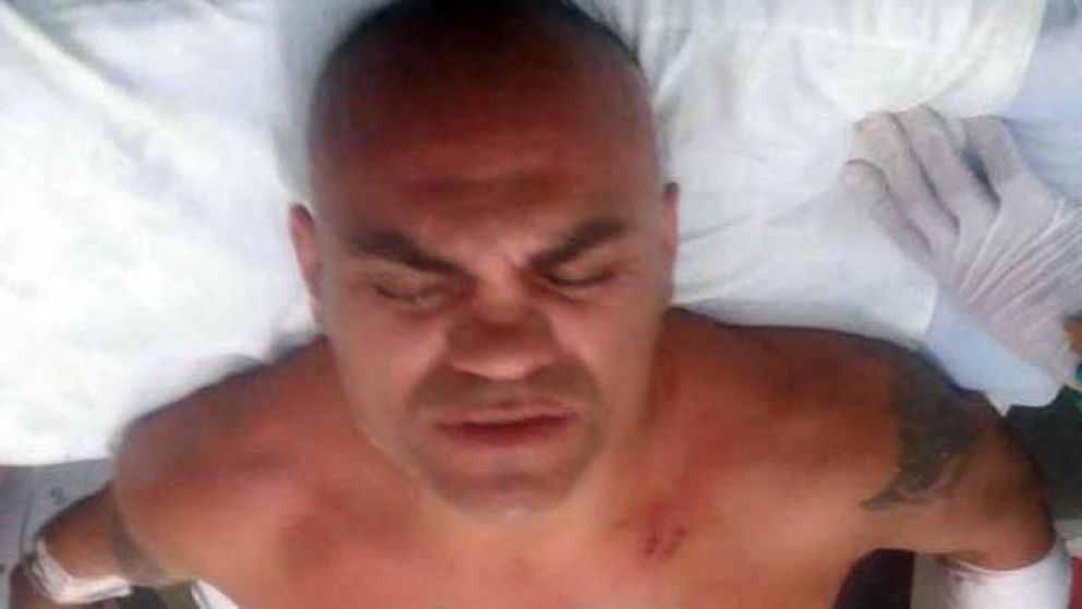 El pugilista recibió, al menos, cuatro puñaladas.