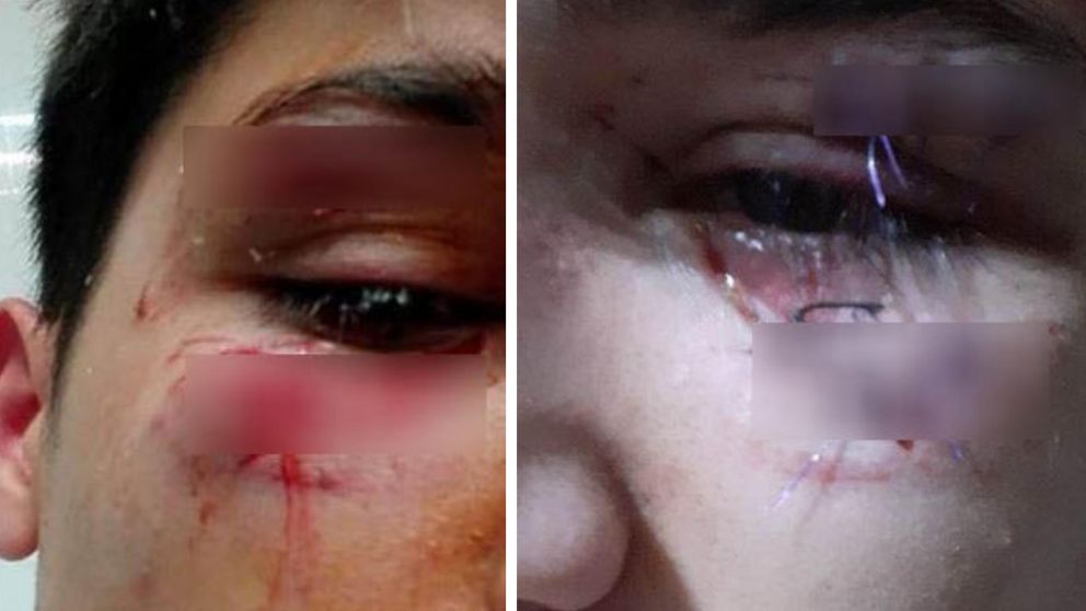 Así quedó la víctima tras el brutal ataque.