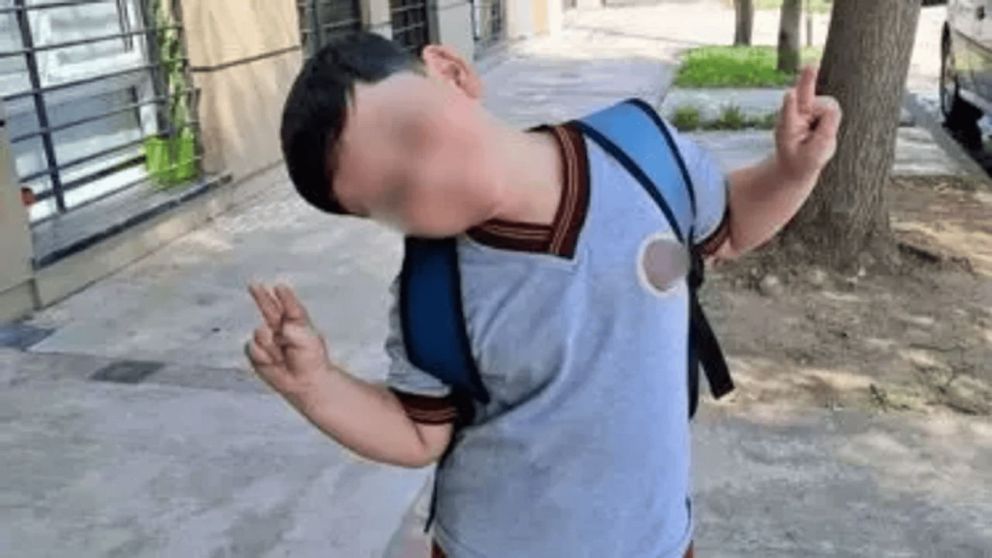 Bastian fue operado por tercera vez.