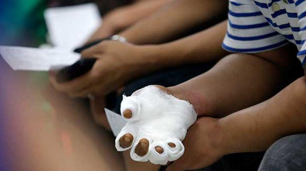 Buscan evitar los riesgos del uso de la pirotecnia. 