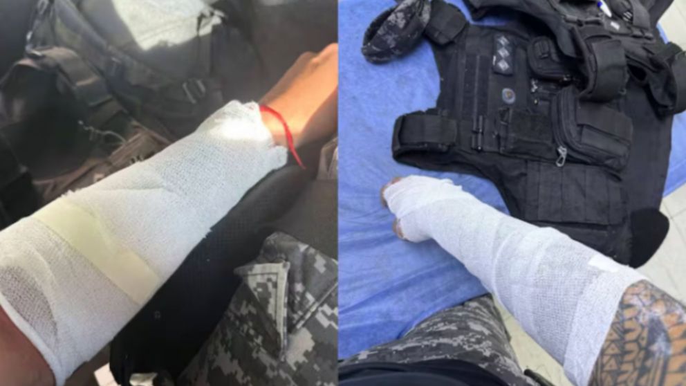 Las lesiones provocadas a las víctimas (Gentileza Policía de Córdoba).