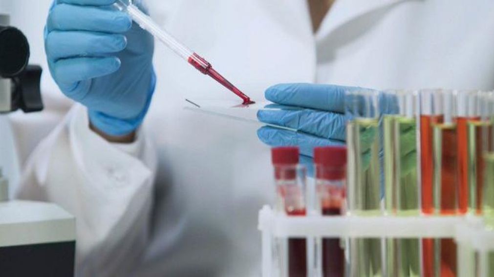 "Sperm Positive" es el primer�banco de esperma de�VIH positivo. (Imagen Ilustrativa)