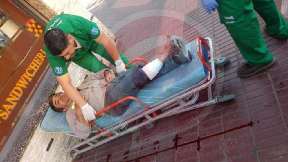 Así quedó el trabajador baleado.