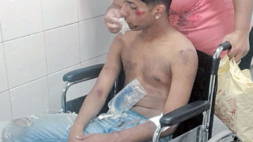 El joven debió ser atendido en la guardia del hospital Equiza.