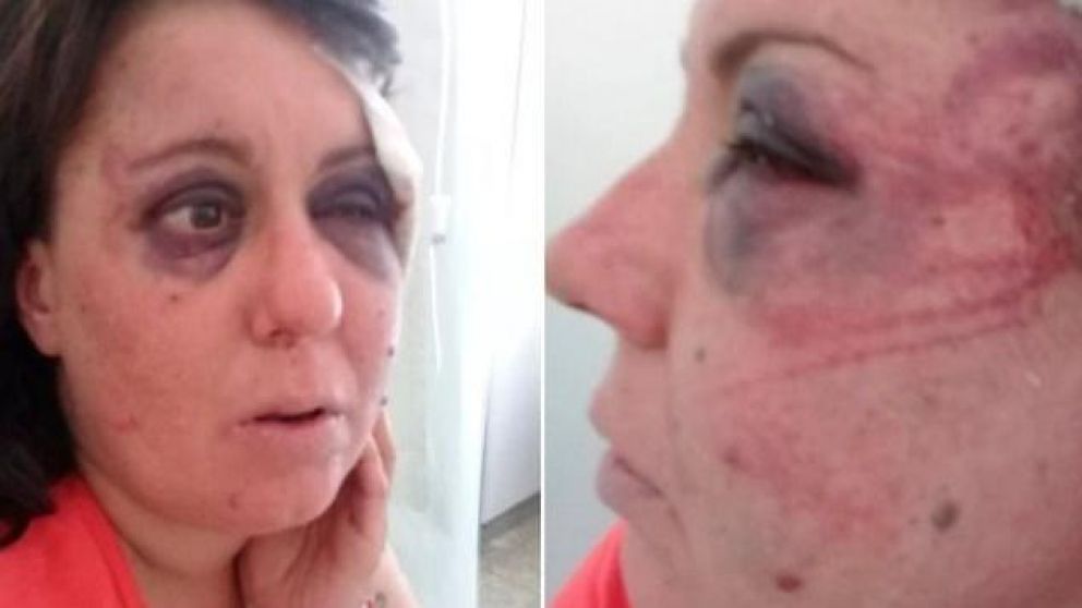 Gisela Knorr fue detenida por efectivos de la Comisaría Tercera de San Clemente del Tuyú tras protagonizar un accidente de tránsito y según denunció recibió una paliza por parte del comisario.