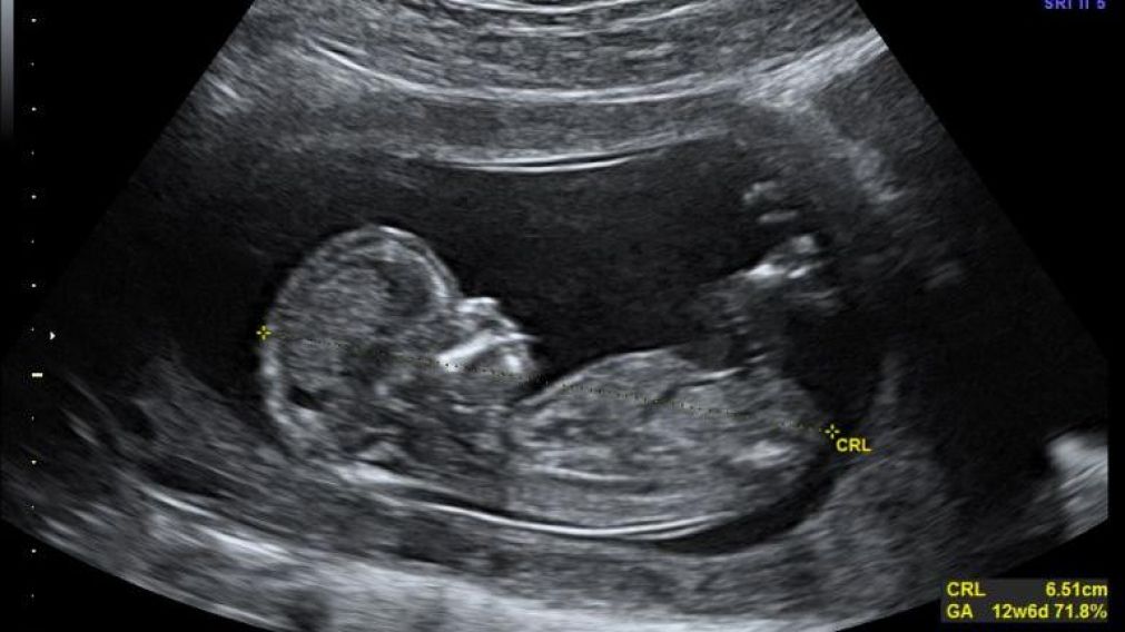 El bebé parecería estar jugando en el vientre y disfrutando (Foto ilustrativa).