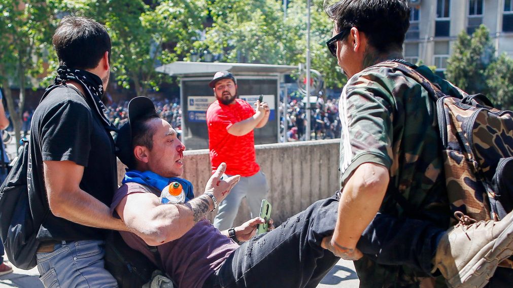 Manifestante herido durante las protestas en Chile.