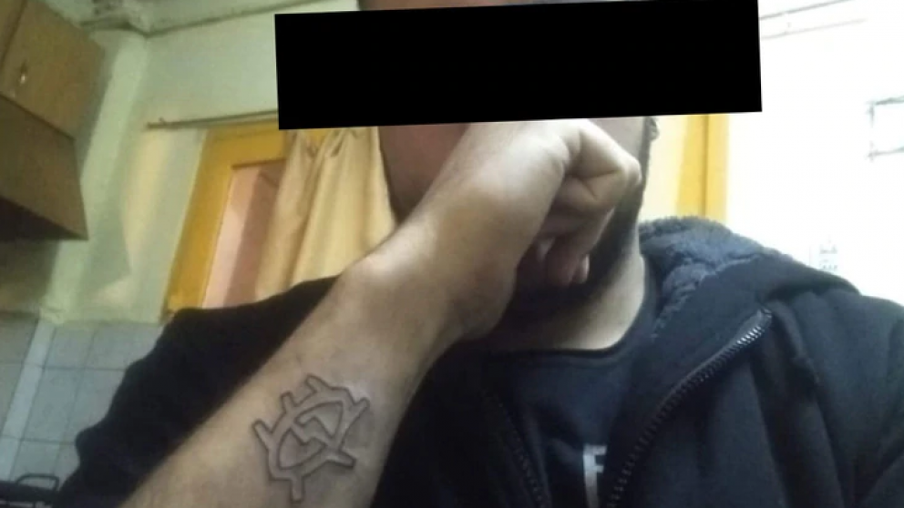 Video: así quedó el brazo del pibe que se sacó el tatuaje con un rallador de queso.