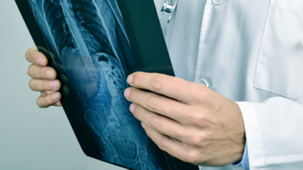 La enfermedad producida por cigarrillos electrónicos conmociona a Estados Unidos (Imagen ilustrativa).