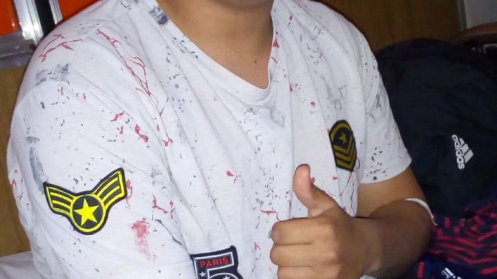 Cristian, de 16 años, puede perder la visión en uno de sus ojos.