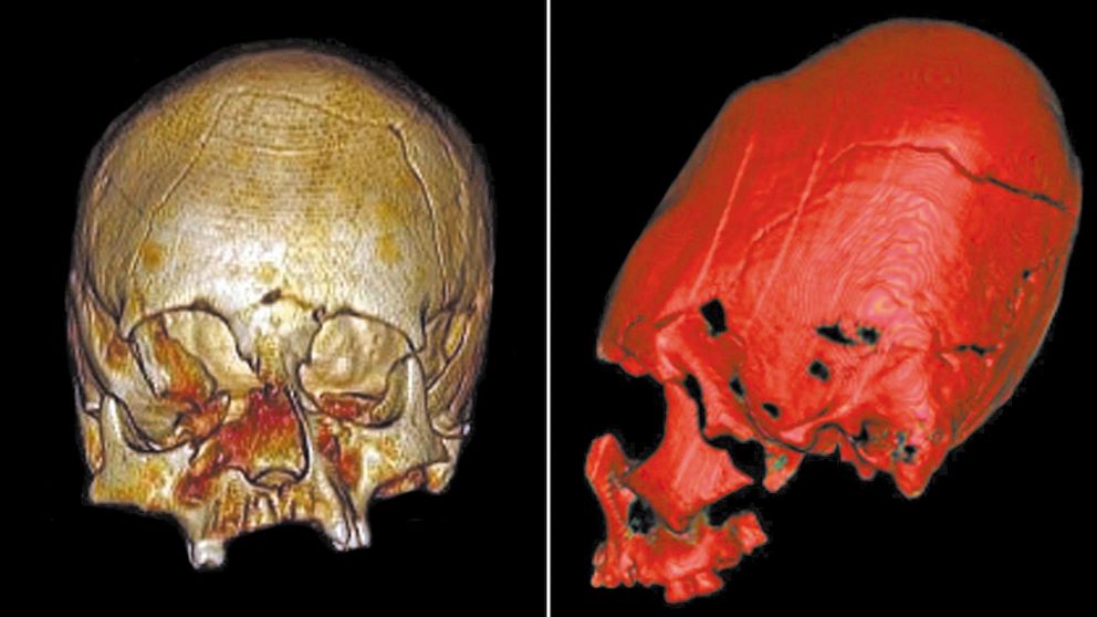 El misterio del hallazgo generó distintas hipótesis.