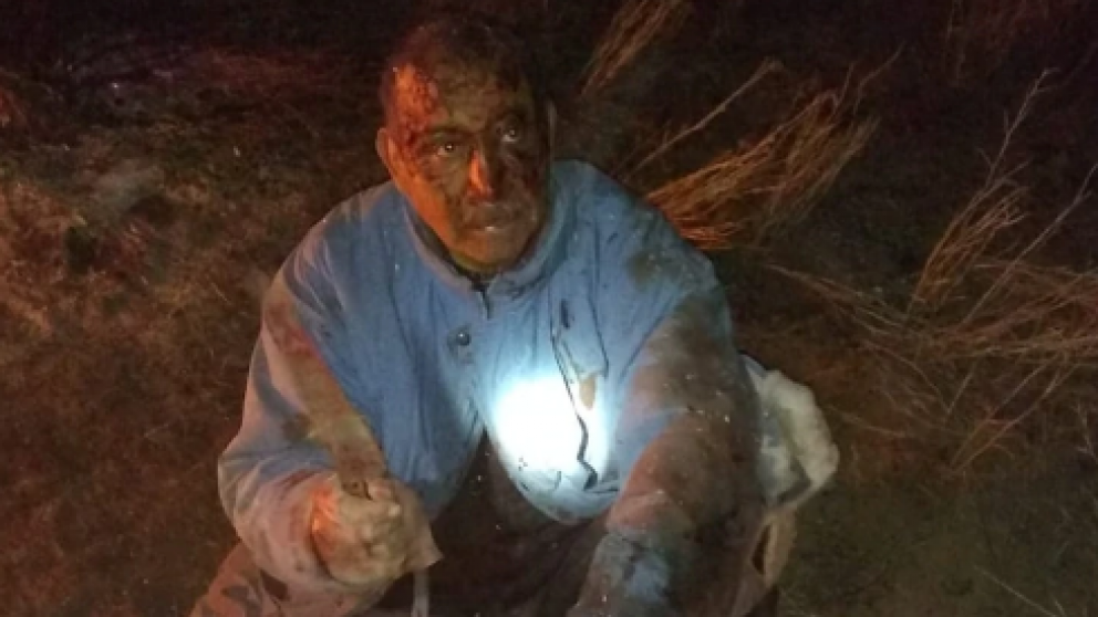 El campesino quedó así luego de la lucha contra el puma.