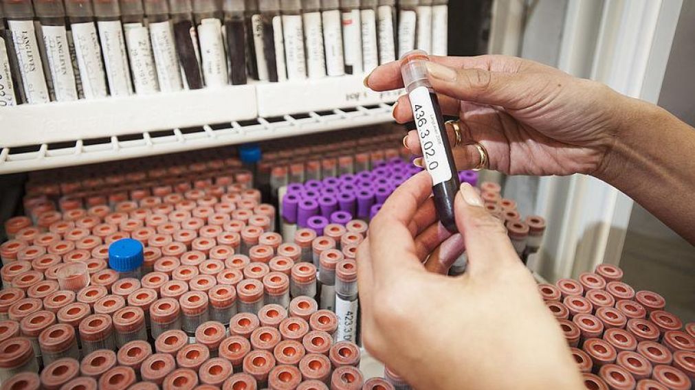 Científicos identificaron biomarcadores en la sangre humana.