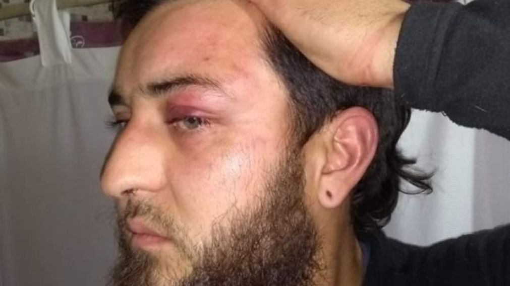 Varios policías fueron detenidos por el hecho. (Gentileza Tiempo de San Juan).