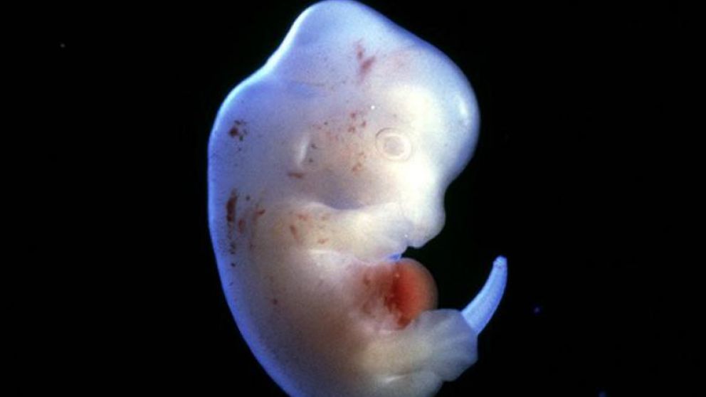 La meta de este nuevo experimento es crear órganos para ser transplantados en humanos.