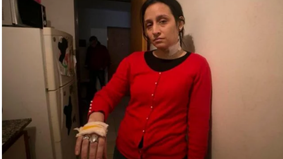El 25 de junio la mujer fue atacada por el agresor con una trincheta en la cabeza, cuello y mano.