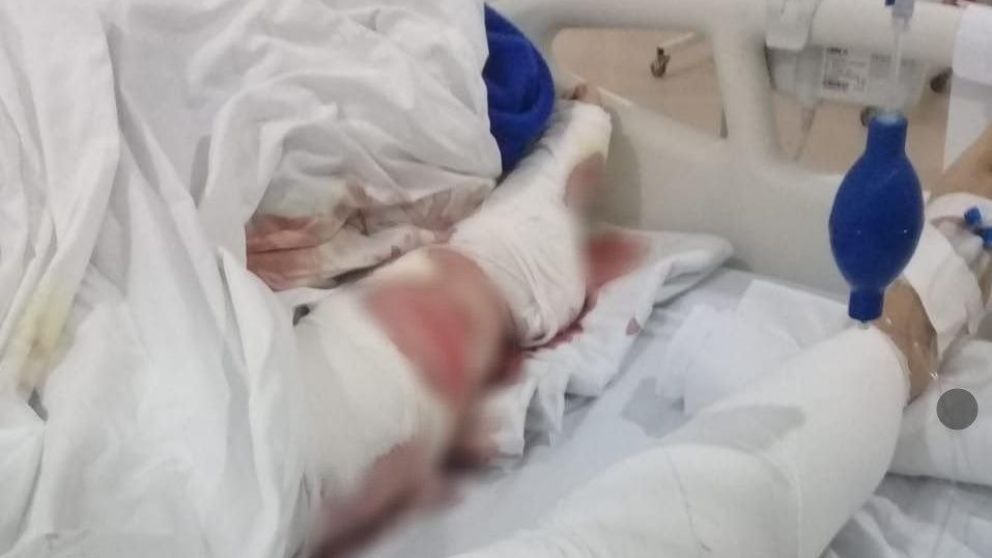 La mujer continuará en terapia tras su intervención quirúrgica.