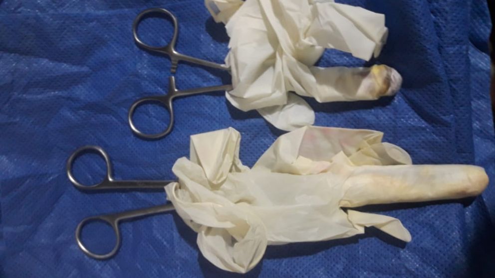 Algunos de los objetos que fueron incautados en el operativo en la vivienda.