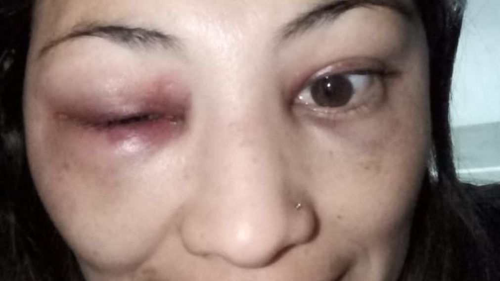 Así quedó la víctima luego de la absurda golpiza.