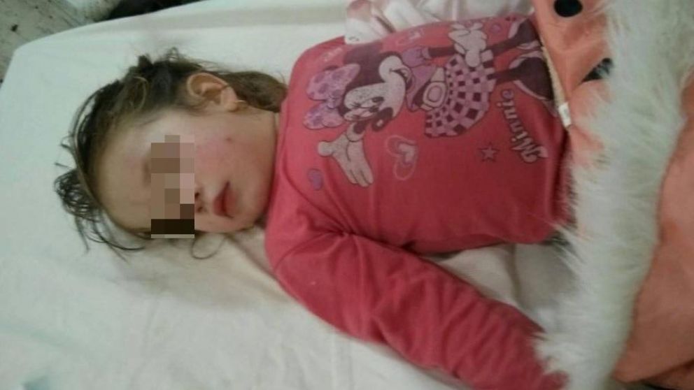La nena de 3 años fue dada de alta en el hospital Eva Perón.