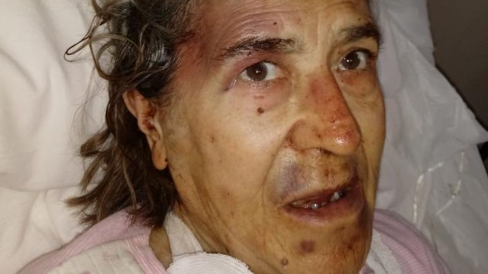 El estado en el que quedó la pobre mujer tras el ataque.