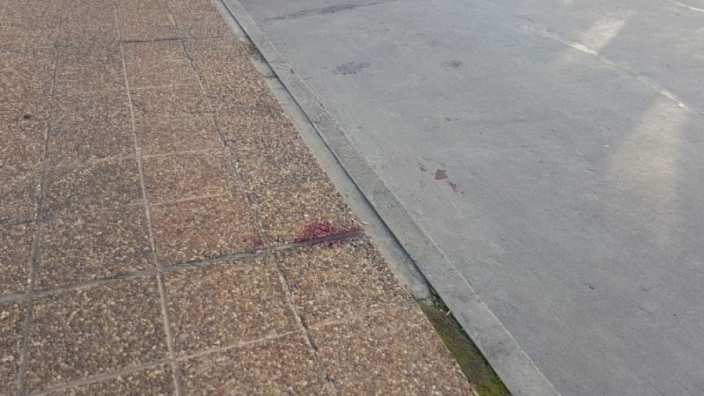 Los restos de la feroz pelea.