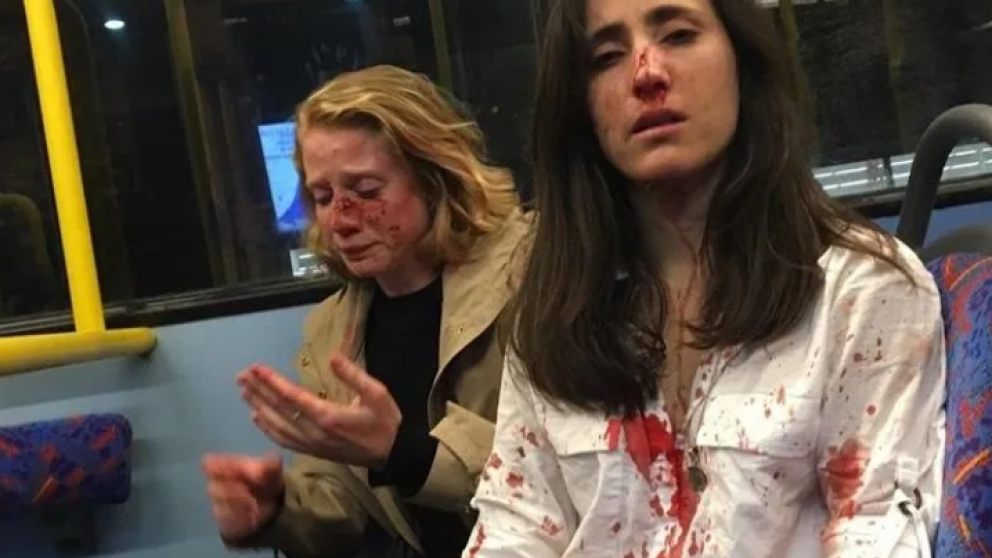 El ataque ocurrió en dentro de un autobus (Facebook).