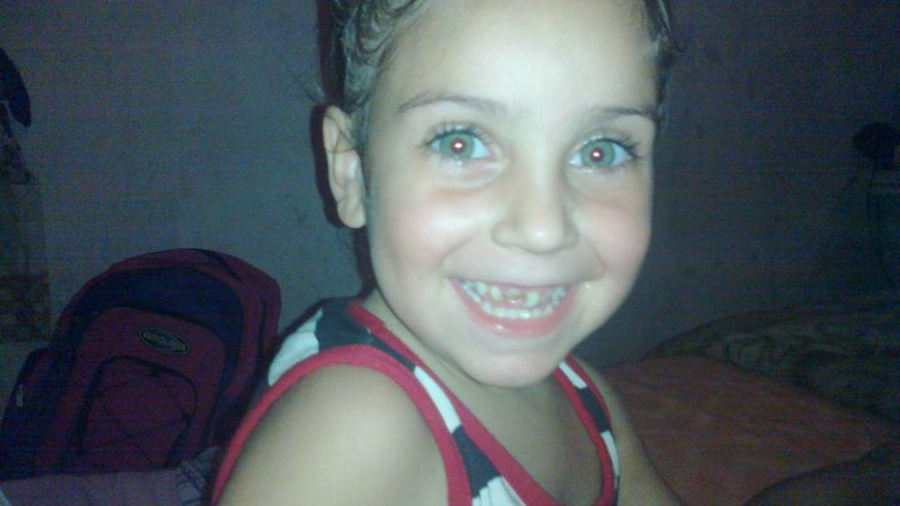 Aymara, la pesqueña que perdió la vida durante una operación.