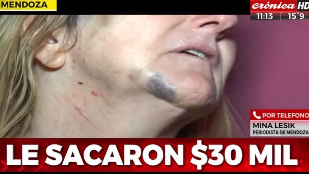 Conmoción en la ciudad mendocina. (Captura de TV).