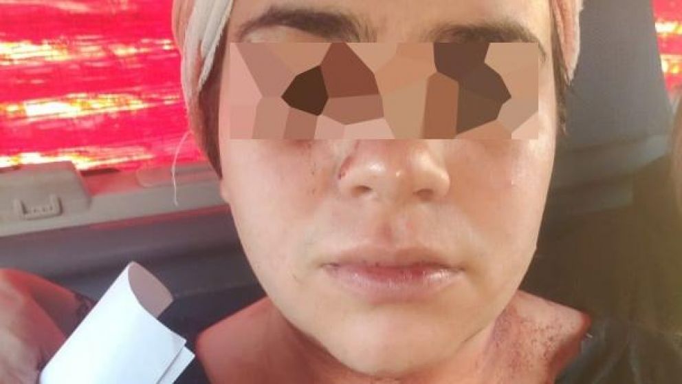 La víctima, de 28 años.