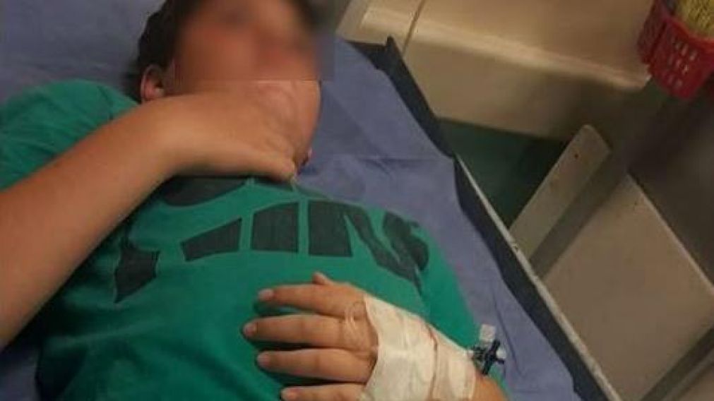 El niño sufrió traumatismo de cráneo.