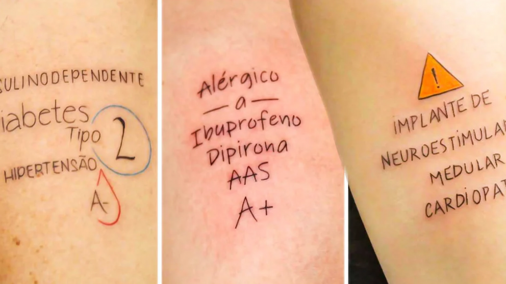 Se hacen en las muñecas para que los médicos lo puedan identificar rápidamente.