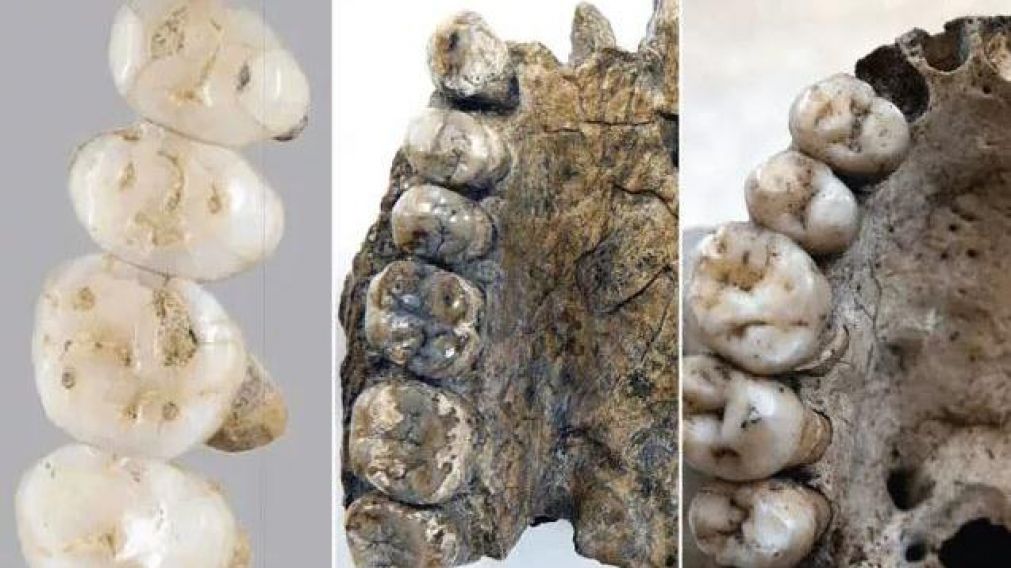 Los dientes fueron clave en el hallazgo. (El Universal).