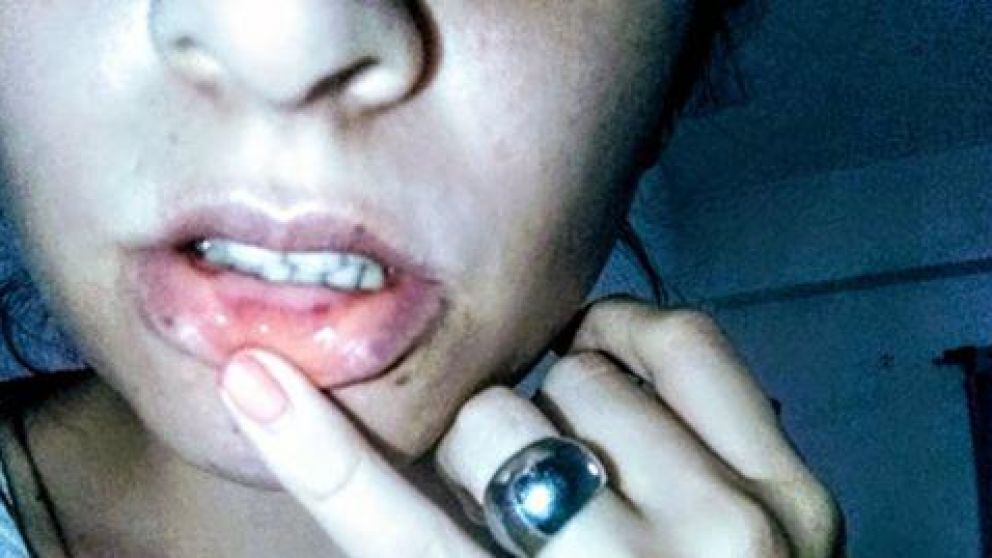 Melina. Recibió golpes en todo su cuerpo.