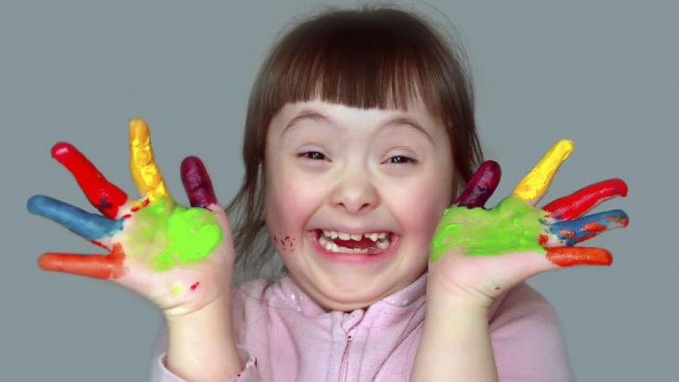 No son diferentes, tampoco especiales, son personas con S�ndrome de Down. 