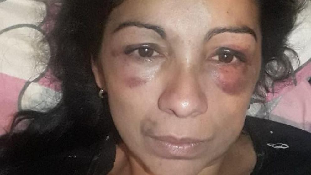 El rostro desfigurado de la mujer luego de los golpes.