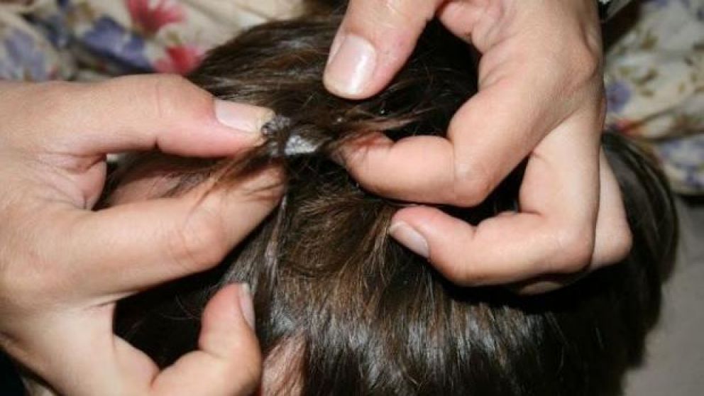 El chico terminó con una profunda herida en la cabeza (Imagen ilustrativa).