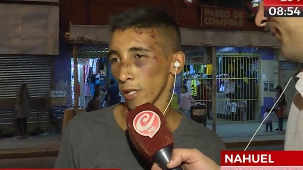 Nahuel. Por la magnitud de las heridas, fue asistido por personal m�dico.