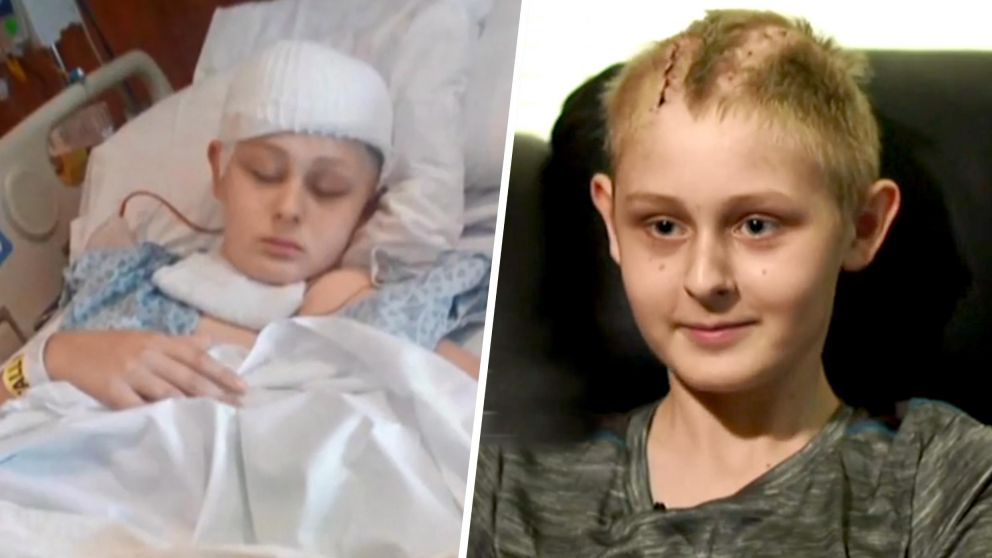 El nene tuvo muerte cerebral y su familia firmó los papeles para donar sus órganos, pero sobrevivió.