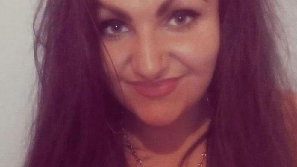 Georgina Paraskeva, la joven que sufrió una extraña alergia.