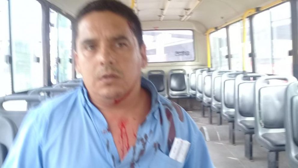 Motoqueros atacaron a escopetazos a colectivero y huyeron