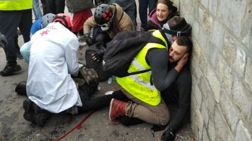 El hombre perdió la mano.