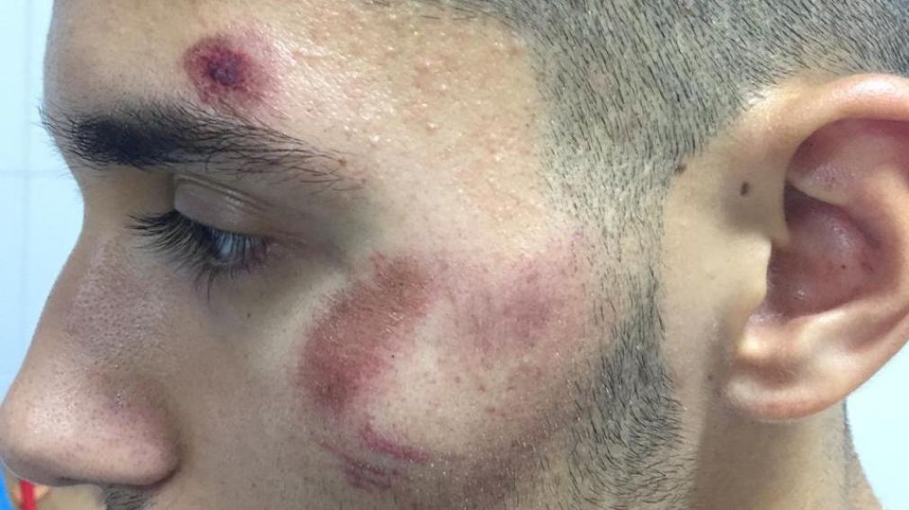 El rostro del hermano de Erreros lo dice todo.