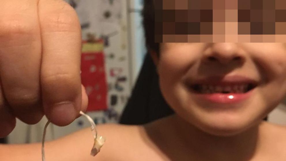 As� le "baj�" un diente al hijo con un cami�n 