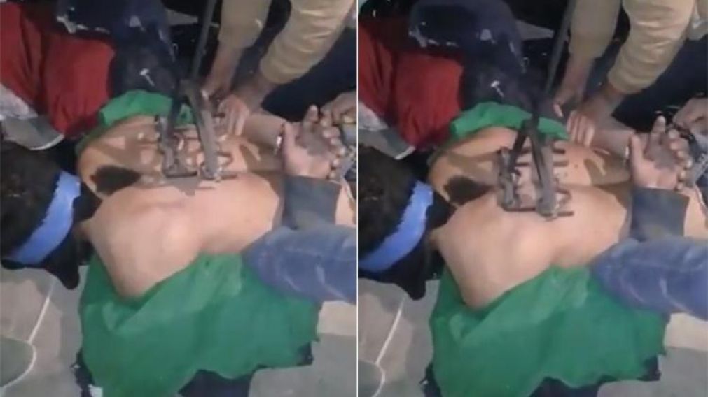 Marcaron con fierro caliente en la espalda a presunto ladrón "por rata"