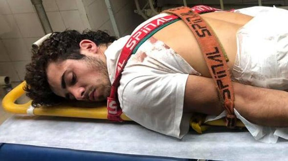 Patovicas golpearon y apuñalaron a pibe en boliche de la Costanera