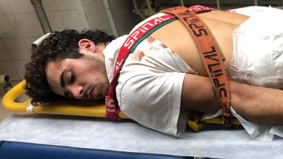 Patovicas golpearon y apuñalaron a pibe en boliche de la Costanera