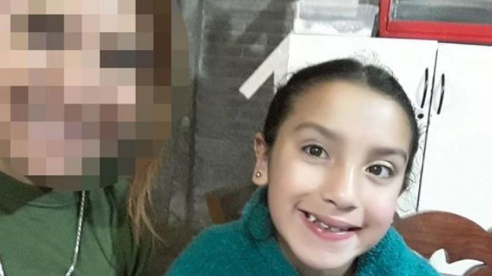 El padre dijo que la cara de la menor estaba desfigurada.