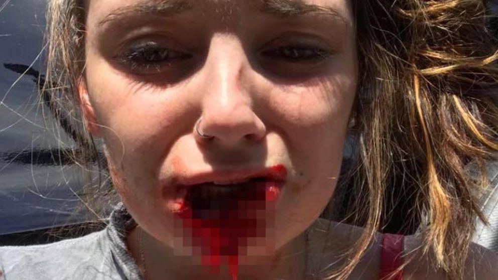 Segundos después del ataque se sacó fotos, lo que ayudó a encarcelar al sujeto.